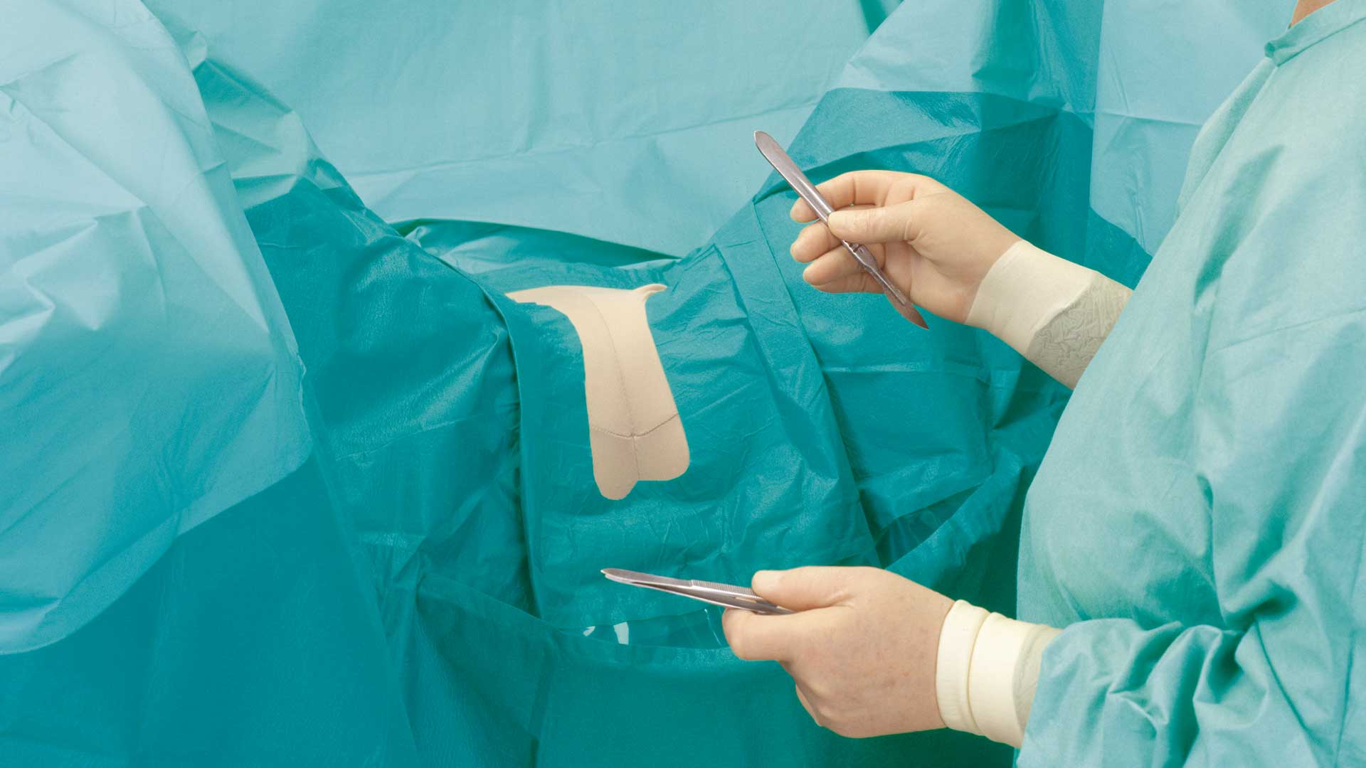 Ein Chirurg, der bei einer Operation ein BARRIER Gynäkologietuch verwendet
